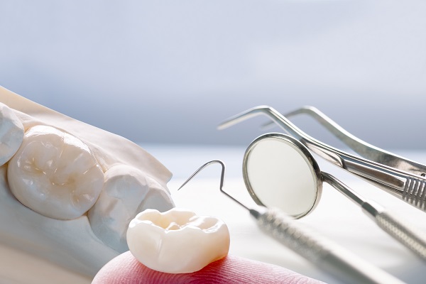 FAQs About CEREC® Crowns