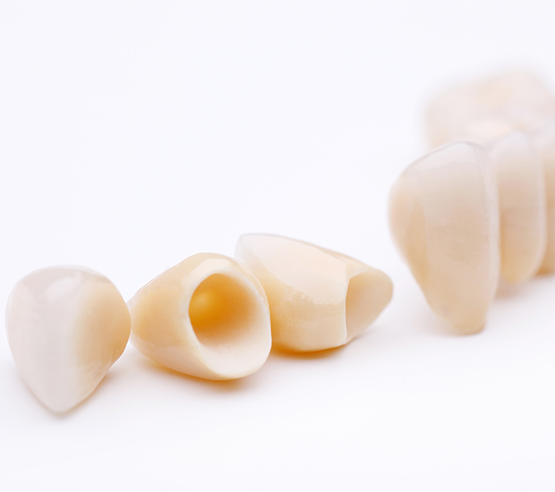 Southington Dental Crowns and Dental Bridges