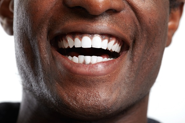 The Right Way To Maintain The Results Of Your Smile Makeover